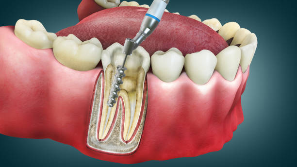 Quality Dental Care In Woodbridge, Va: Your Trusted Dentists!